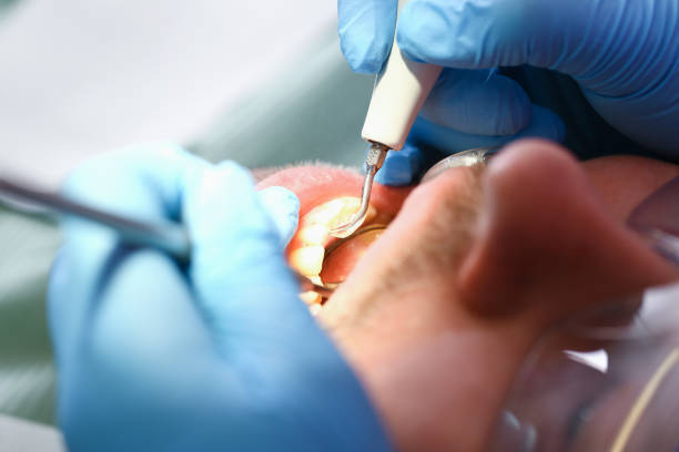 Best Emergency Dentist for Lost Fillings or Crowns in Muskegon Heights, MI