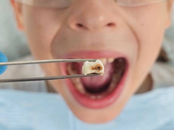 Best Orthodontic Emergency Dentist in Muskegon Heights, MI