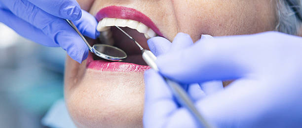 Best Emergency Dentist for Knocked-Out Tooth in Muskegon Heights, MI